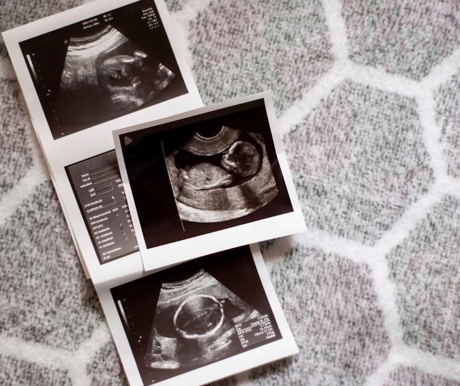 Pregnant woman in her second trimester smiling and gently holding her growing belly in a cozy home setting