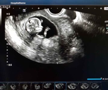 First trimester symptoms chart showing normal changes and warning signs.